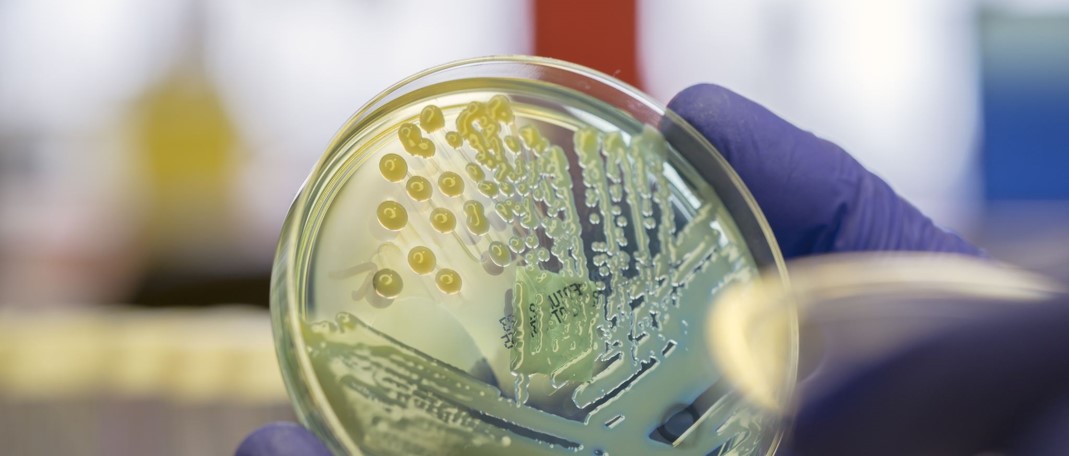 Webinar: AMRの脅威と製薬企業の責任 The Threat of AMR and Pharmaceutical Responsibility